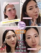 美國 INTELLIGENT NUTRIENTS RENEWALCOMPLEX SKINSERUM 12ml*1pc