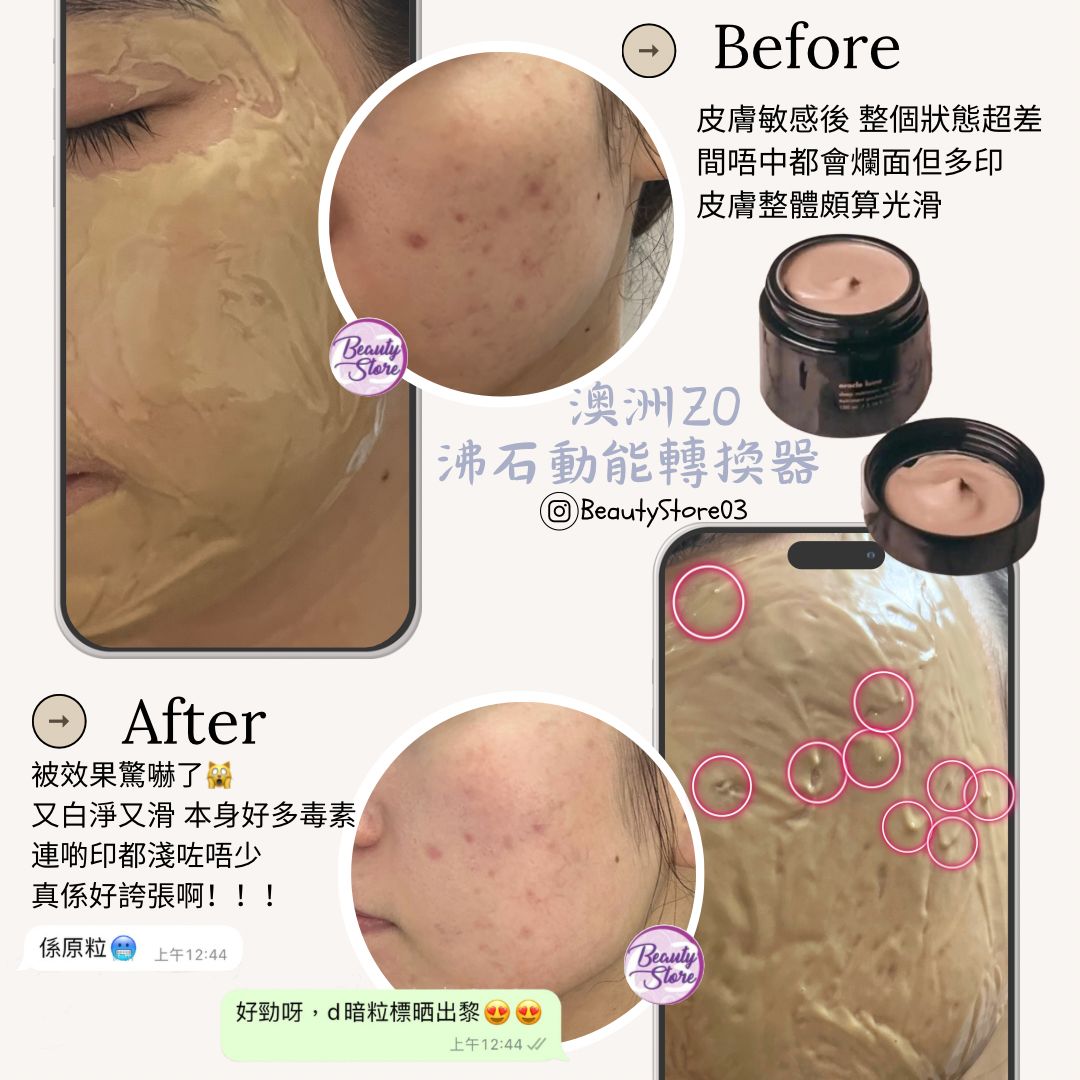 澳洲 ZO Oracle Lume – Deep Nutriment Resurfacing Masque沸石動能轉換器 100ml