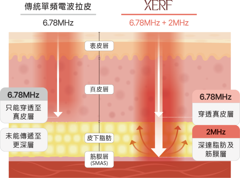 全球獨有雙頻電波